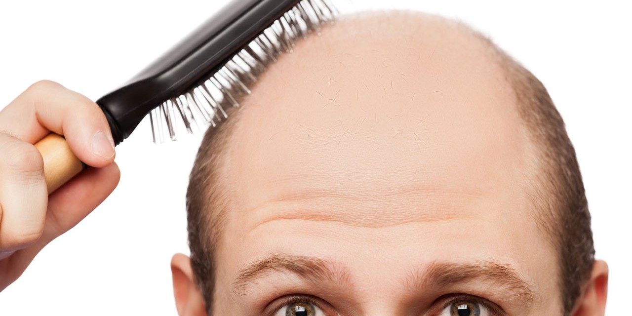 3 Ways To Treat Hair Loss