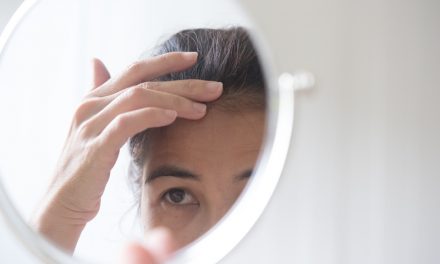 Psychological impact of hair loss to women
